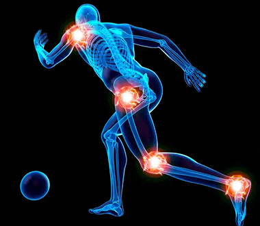 Sports Injuries