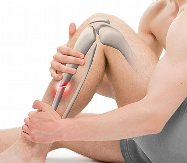Arthroscopy 