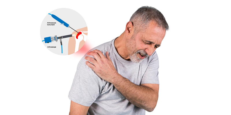Sports Injury
